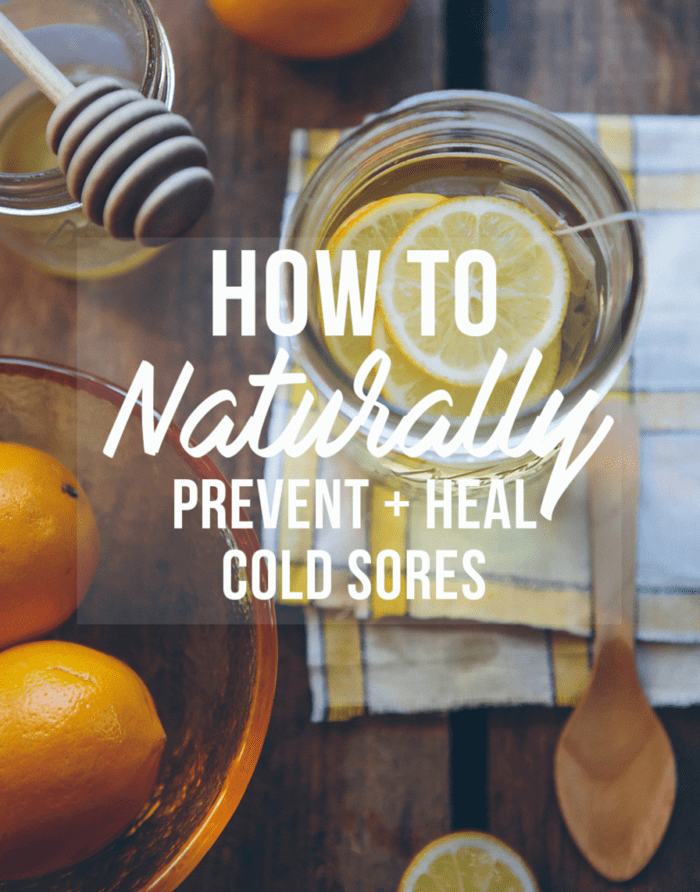 How to prevent and treat cold sores naturally! Here I'm sharing what foods to avoid, which supplements to take and which natural oils work for healing cold sores. 