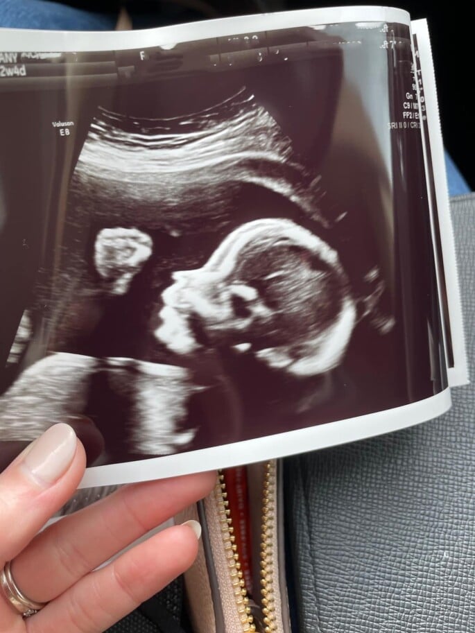 Baby ultrasound photo.